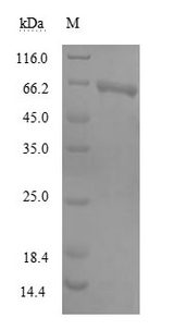 MIER2 Protein - (Tris-Glycine gel) Discontinuous SDS-PAGE (reduced) with 5% enrichment gel and 15% separation gel.