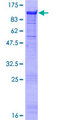 MIER3 Protein - 12.5% SDS-PAGE of human DKFZP781I1119 stained with Coomassie Blue