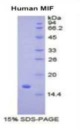 MIF Protein - Recombinant Macrophage Migration Inhibitory Factor By SDS-PAGE