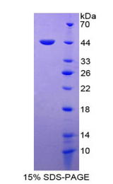 MIF Protein - Recombinant Macrophage Migration Inhibitory Factor By SDS-PAGE