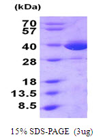 MIF Protein