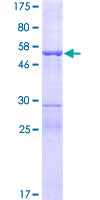 MIF4GD Protein - 12.5% SDS-PAGE of human MIF4GD stained with Coomassie Blue