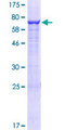 MINA / MINA53 Protein - 12.5% SDS-PAGE of human MINA stained with Coomassie Blue