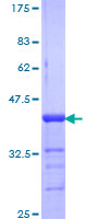 Mineralocorticoid Receptor Protein - 12.5% SDS-PAGE Stained with Coomassie Blue.