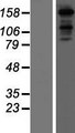 MINK1 / MINK Protein - Western validation with an anti-DDK antibody * L: Control HEK293 lysate R: Over-expression lysate