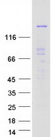 MINK1 / MINK Protein - Purified recombinant protein MINK1 was analyzed by SDS-PAGE gel and Coomassie Blue Staining
