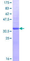 MINPP1 Protein - 12.5% SDS-PAGE Stained with Coomassie Blue.