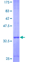 MIP2 / GRO2 / CXCL2 Protein - 12.5% SDS-PAGE of human CXCL2 stained with Coomassie Blue