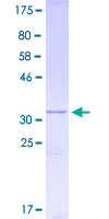 MIP2 / GRO2 / CXCL2 Protein - 12.5% SDS-PAGE Stained with Coomassie Blue.