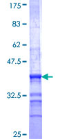 MIR16 / GDE1 Protein - 12.5% SDS-PAGE Stained with Coomassie Blue.