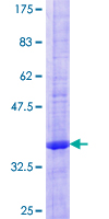 MIRP1 / KCNE2 Protein - 12.5% SDS-PAGE of human KCNE2 stained with Coomassie Blue