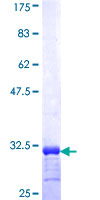 MIRP1 / KCNE2 Protein - 12.5% SDS-PAGE Stained with Coomassie Blue.