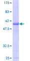MIS12 Protein - 12.5% SDS-PAGE of human MIS12 stained with Coomassie Blue