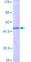 MIS12 Protein - 12.5% SDS-PAGE of human MIS12 stained with Coomassie Blue