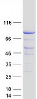 MISP / C19orf21 Protein - Purified recombinant protein MISP was analyzed by SDS-PAGE gel and Coomassie Blue Staining