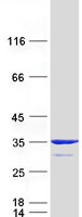 MITD1 Protein - Purified recombinant protein MITD1 was analyzed by SDS-PAGE gel and Coomassie Blue Staining