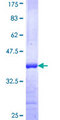 Mitofusin 2 / MFN2 Protein - 12.5% SDS-PAGE Stained with Coomassie Blue.