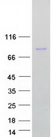 Mitofusin 2 / MFN2 Protein - Purified recombinant protein MFN2 was analyzed by SDS-PAGE gel and Coomassie Blue Staining