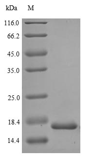 MKI67 / Ki67 Protein - (Tris-Glycine gel) Discontinuous SDS-PAGE (reduced) with 5% enrichment gel and 15% separation gel.