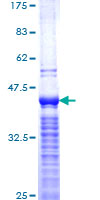 MKI67 / Ki67 Protein - 12.5% SDS-PAGE Stained with Coomassie Blue.