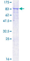 MKKS Protein - 12.5% SDS-PAGE of human MKKS stained with Coomassie Blue