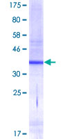 MKLN1 / Muskelin Protein - 12.5% SDS-PAGE Stained with Coomassie Blue.