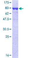 MKNK1 / MNK1 Protein - 12.5% SDS-PAGE of human MKNK1 stained with Coomassie Blue