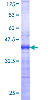 MKNK1 / MNK1 Protein - 12.5% SDS-PAGE Stained with Coomassie Blue.
