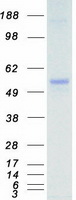 MKNK1 / MNK1 Protein - Purified recombinant protein MKNK1 was analyzed by SDS-PAGE gel and Coomassie Blue Staining