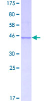 MKNK2 / MNK2 Protein - 12.5% SDS-PAGE of human MKNK2 stained with Coomassie Blue