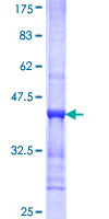 MKNK2 / MNK2 Protein - 12.5% SDS-PAGE Stained with Coomassie Blue.