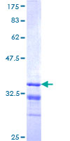 MKRN1 Protein - 12.5% SDS-PAGE Stained with Coomassie Blue.