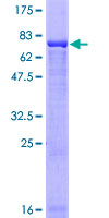 MKRN2 Protein - 12.5% SDS-PAGE of human MKRN2 stained with Coomassie Blue