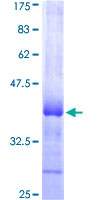 MKRN2 Protein - 12.5% SDS-PAGE Stained with Coomassie Blue.