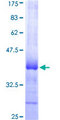 MKRN2 Protein - 12.5% SDS-PAGE Stained with Coomassie Blue.