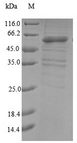 MKRN3 Protein - (Tris-Glycine gel) Discontinuous SDS-PAGE (reduced) with 5% enrichment gel and 15% separation gel.