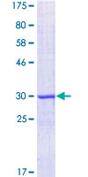MKRN3 Protein - 12.5% SDS-PAGE Stained with Coomassie Blue.