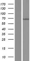 MKS1 Protein - Western validation with an anti-DDK antibody * L: Control HEK293 lysate R: Over-expression lysate