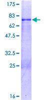 MKX Protein - 12.5% SDS-PAGE of human IRXL1 stained with Coomassie Blue