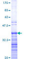MKX Protein - 12.5% SDS-PAGE Stained with Coomassie Blue.