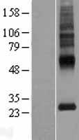 MLC1 / MLC Protein - Western validation with an anti-DDK antibody * L: Control HEK293 lysate R: Over-expression lysate