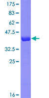 MLC2 / MYL9 Protein - 12.5% SDS-PAGE of human MYL9 stained with Coomassie Blue