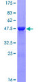 MLC3F / MYL1 Protein - 12.5% SDS-PAGE of human MYL1 stained with Coomassie Blue