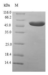 MLC3F / MYL1 Protein - (Tris-Glycine gel) Discontinuous SDS-PAGE (reduced) with 5% enrichment gel and 15% separation gel.