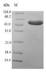 MLC3F / MYL1 Protein - (Tris-Glycine gel) Discontinuous SDS-PAGE (reduced) with 5% enrichment gel and 15% separation gel.