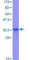 MLC3F / MYL1 Protein - 12.5% SDS-PAGE Stained with Coomassie Blue.