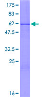 MLF1 Protein - 12.5% SDS-PAGE of human MLF1 stained with Coomassie Blue