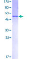 MLF2 Protein - 12.5% SDS-PAGE of human MLF2 stained with Coomassie Blue