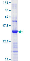 MLH1 Protein - 12.5% SDS-PAGE Stained with Coomassie Blue.