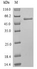 MLKL Protein - (Tris-Glycine gel) Discontinuous SDS-PAGE (reduced) with 5% enrichment gel and 15% separation gel.